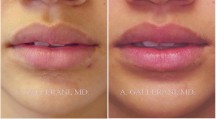 Lips - Patient D