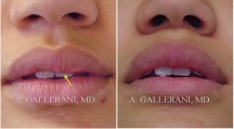 Lips - Patient D