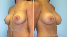 Breast Reconstruction - Patient E