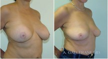 Breast Reconstruction - Patient N